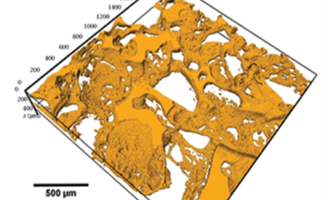 Improving Pore Network Imaging And Characterization Of Microporous Carbonate Rocks Using Multi ...